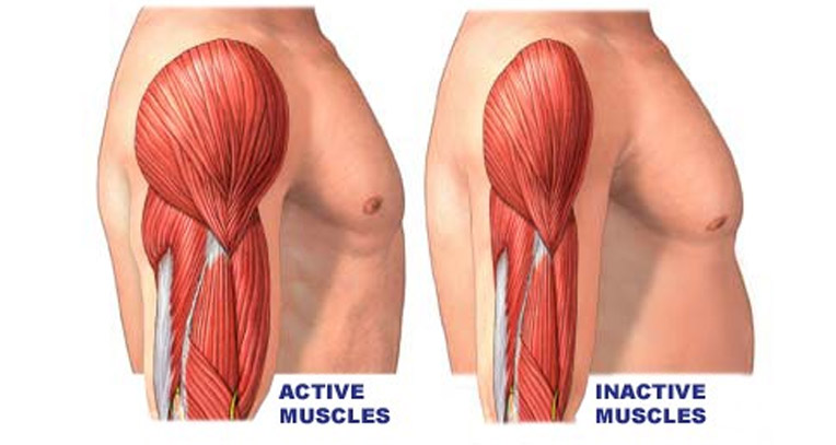 Muskelfibre i overarm